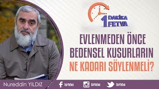 Evlenmeden önce bedensel kusurların ne kadarı söylenmeli? / Birfetva - Nureddin Yıldız