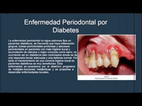 presentacion-diabetes-mellitus-en-odontologia