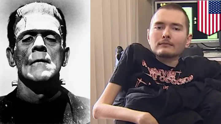 World's first head transplant planned by doctor who compares himself to Frankenstein - TomoNews