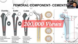 Biomechanics of Total Hip Replacement for the FRCSOrth