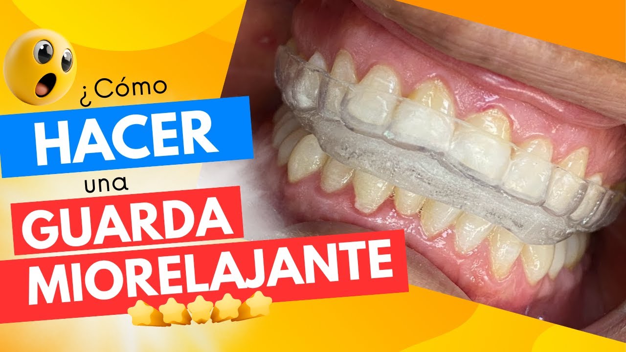 ¿Cómo realizar una guarda / placa miorelajante? en 8 minutos! GuantesAzules