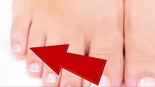 Dedo dolor del punzante pequeño pie el en