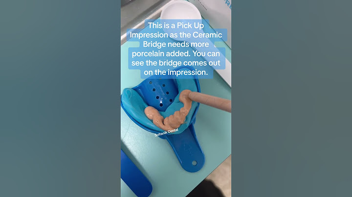 The Pick Up Mold #shorts #youtubeshorts #mold #short