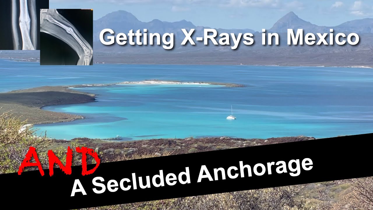 Getting X-rays in Mexico and A Secluded Anchorage | Sailing with Six | S2 E8