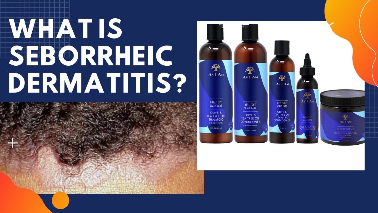 NeilMed Sinus Rinse Update! Finding out I had Seborrheic Dermatitis! Creating my own cure?!