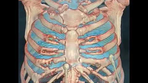 Coronavirus: These are what COVID-19 infected lungs look like | ABC7 - DayDayNews