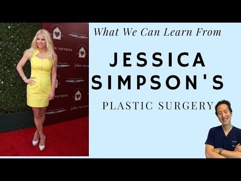 Did Jessica Simpson Get Plastic Surgery