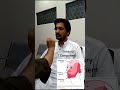 Trigeminal cranial nerve 5  examinationcranial nerve examinationtrigeminal by dr bk