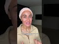 Cosmelan Journey - The Worlds Leading Depigmentation Treatment