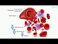 pancytopenia (English) - Medical terminology for medical students -