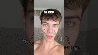 why do you have #eyebags #looksmax #tutorial