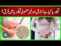 Leucorrhea: Causes, Symptoms & Difference Between Normal & Abnormal | Dr. Kanwal Nooshin
