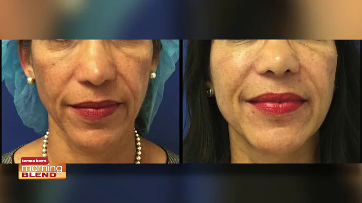 Heather Scull, PA-C Discusses The Hottest Trends I...