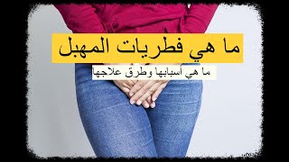 فطريات المهبل - ما هي فطريات المهبل ؟ ما هي أسبابها وطرق علاجها