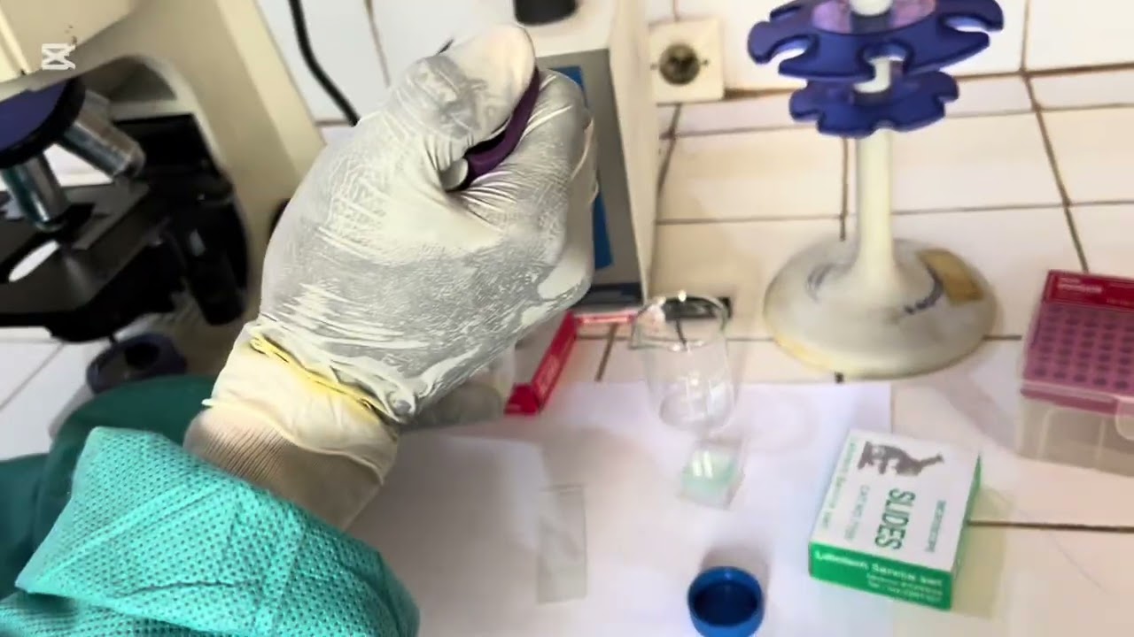 L’akinétozoospermie lors du spermogramme complet #foryou #bollywood 