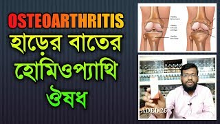 অস্টিও আর্থ্রাইটিস হাড়ের বাতের হোমিওপ্যাথি ঔষধ চিকিৎসা ও উপায় | osteoarthritis treatment in bangla