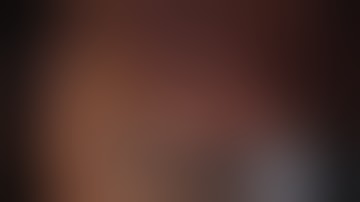 LAPAROSCOPIC D2 LYMPHADENECTOMY - Dr. Archit Pandit