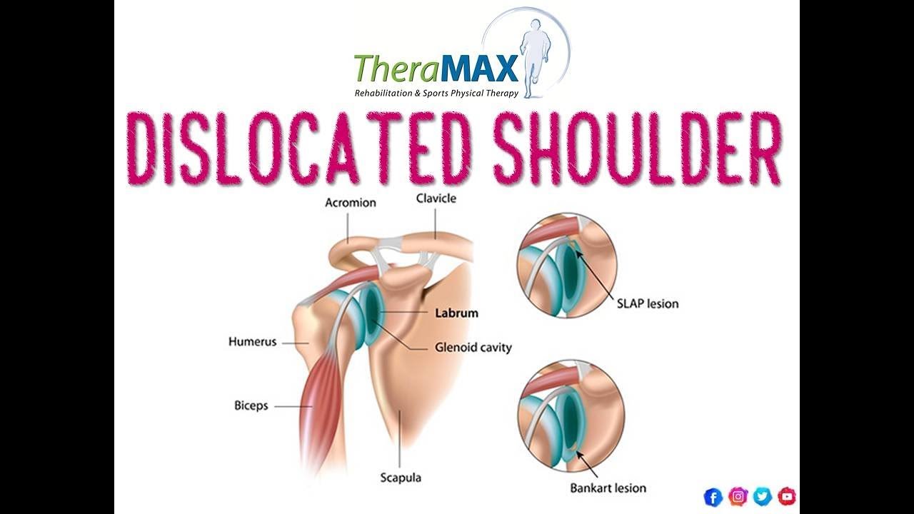 Dislocated Shoulder YouTube
