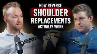 Reverse Shoulder Replacement Explained: Why We Reverse the Shoulder & What to Expect