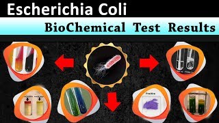 Escherichia coli Biochemical test results