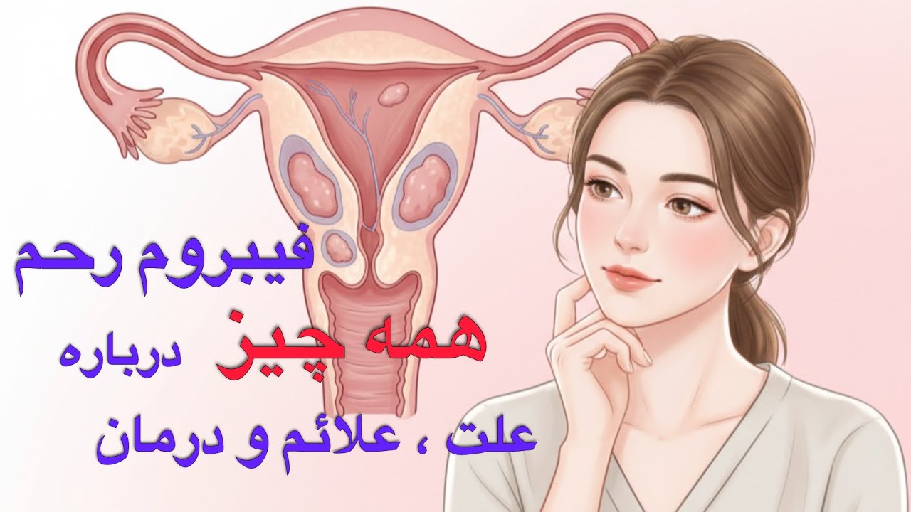 فیبروم رحم : علت ، علائم ، تشخیص و درمان