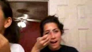 The Worlds Worst Sunburn..