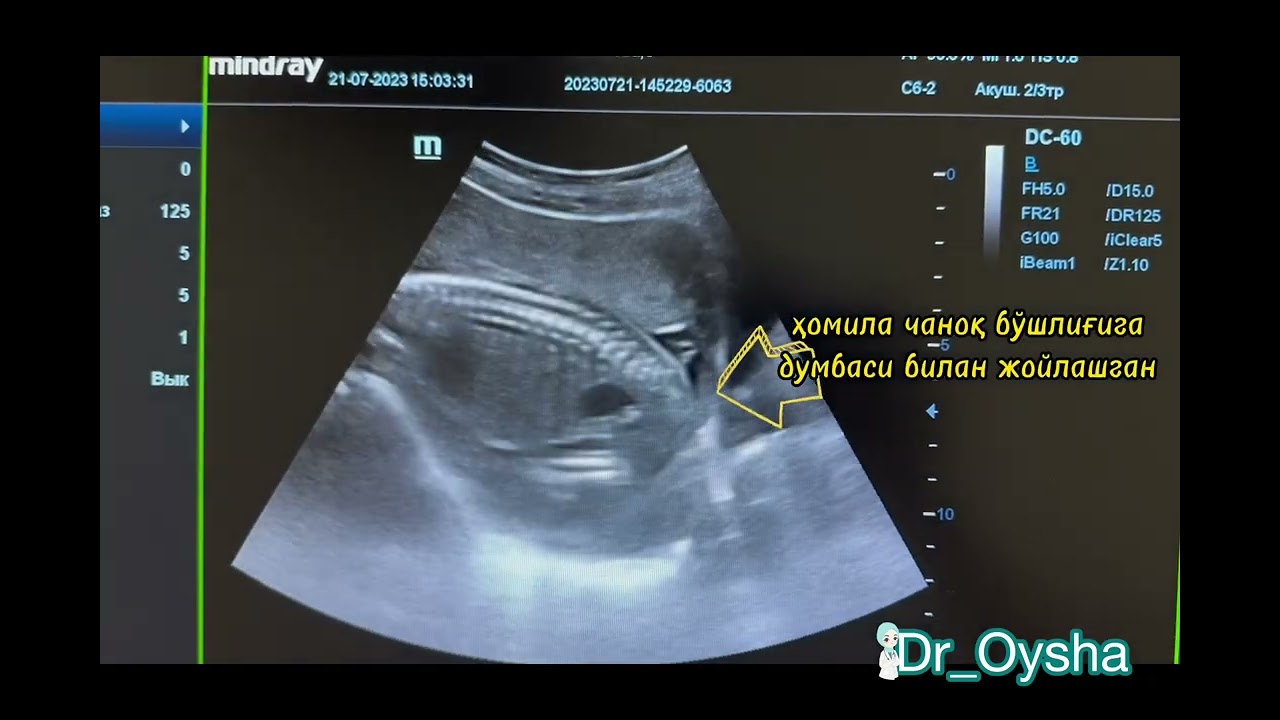 Qishloq nikoh seks hikoyalar