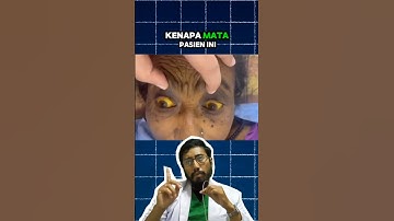PENYAKIT KUNING 😱 #faktakesehatan #faktaunik