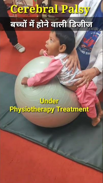 (सेरेब्रल पाल्सी) Cerebral Palsy  #physiodrdeepaksoni #cerebralpalsy