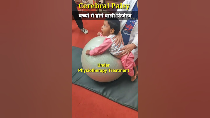 (सेरेब्रल पाल्सी) Cerebral Palsy  #physiodrdeepaksoni #cerebralpalsy