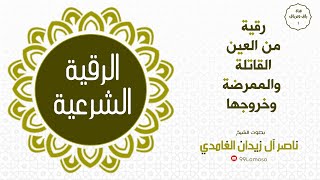 رقية من العين القاتلة و الممرضة و خروجها بإذن الله - الشيخ ناصر زيدان الغامدي ~