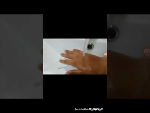 Как сломать палец на руке без причины в домашних условиях