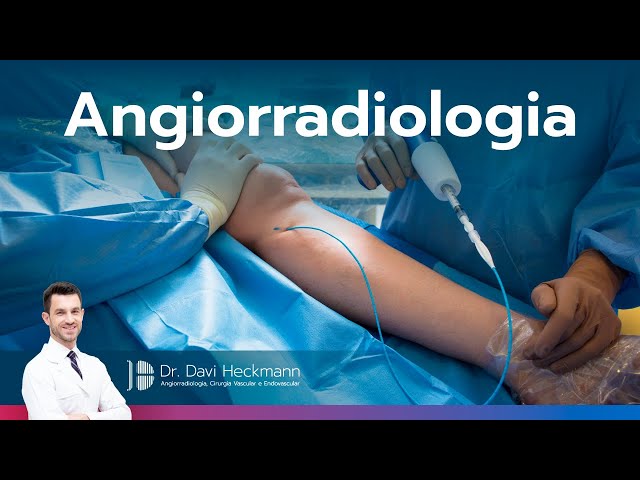 O que é a angiorradiologia | Dr. Davi Heckmann