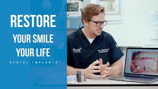 Dental implants: Restore your smile, restore your life. Trust Implants.