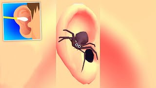 Earwax Clinic Pro Levels Gameplay Walkthrough iOS,Android  Newtrailers Pro Mobile Game Update SDT18N screenshot 2