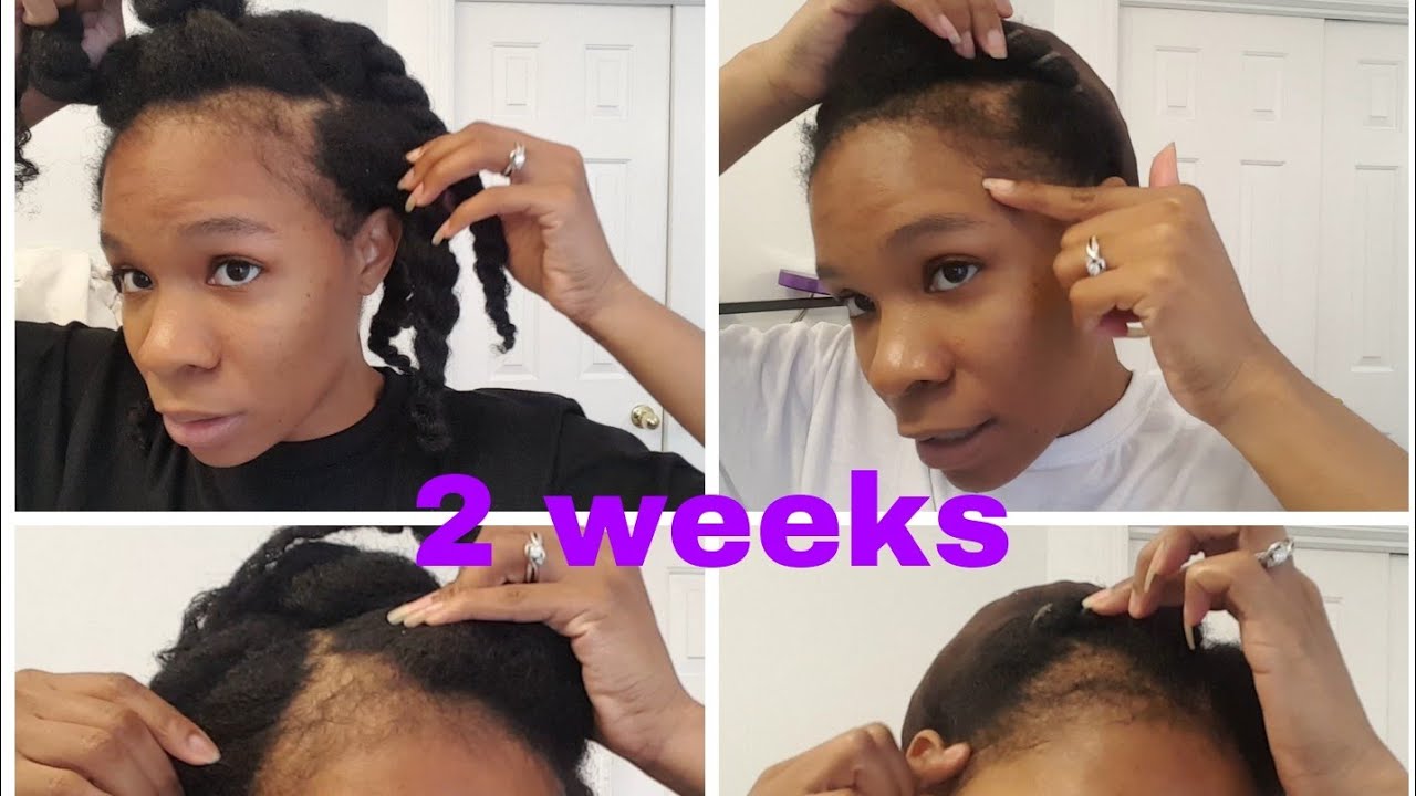 Grow Edges Extremely Fast with Ayurvedic Oils