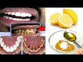 How to whiten your yellow teeth naturally at home / get white and shiny teeth.