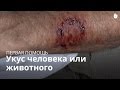 Учись первой помощи: укус животного и человека