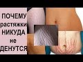 РАСТЯЖКИ: за что мне это и как их убрать??? #смирисьснеизбежным