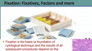 Histopathology-Fixative & Fixation Introduction,Factors Affecting of Fixative and Types of Fixative