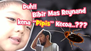Duh!!..Bibir Mas Reynand kena \