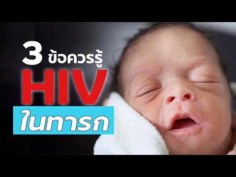 3 ข้อควรรู้ HIV ในเด็ก ทารก ติดเอดส์ AIDS