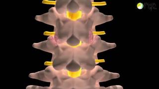 Lumbar Facet Joint injection under X-ray Guidance
