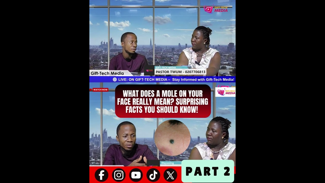 PART 2 👀 What Does a Mole on Your Face Really Mean? Surprising Meanings You Should Know! ✨