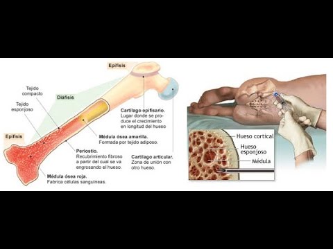 Cuantas veces se puede donar médula ósea