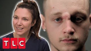 Patient Says His Cyst Makes Him Feel Like A “Cyclops” | The Bad Skin Clinic