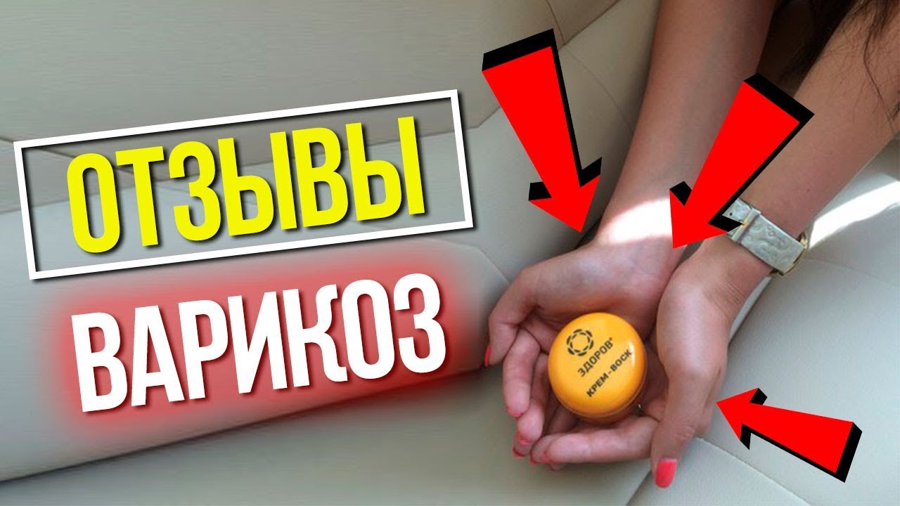 Как Вылечить Варикоз на Ногах в Домашних Условиях. Лечим Варикоз Дома ...