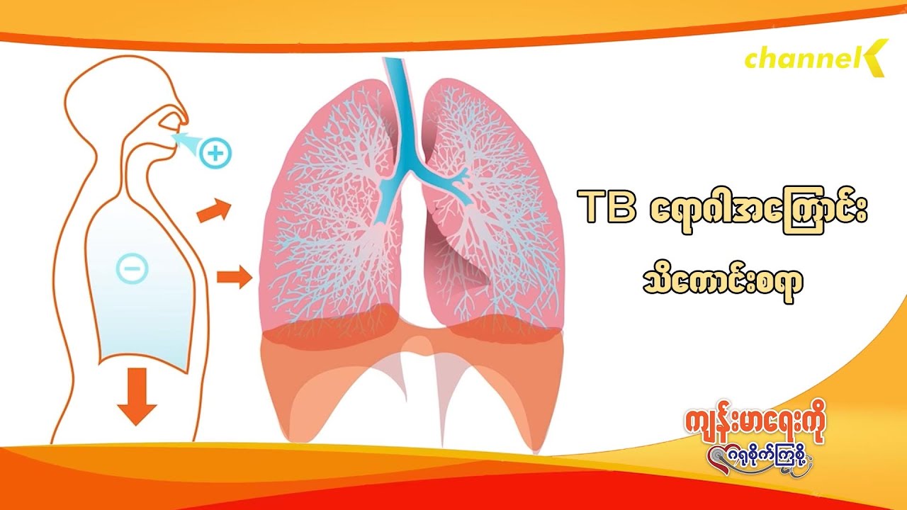 ကျန်းမာရေးကိုဂရုစိုက်ကြစို့ - အပိုင်း (၁၀) TB ရောဂါအကြောင်းသိကောင်းစရာ