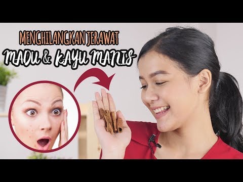 Yuk Hilangkan Jerawat dengan Madu dan Kayu Manis