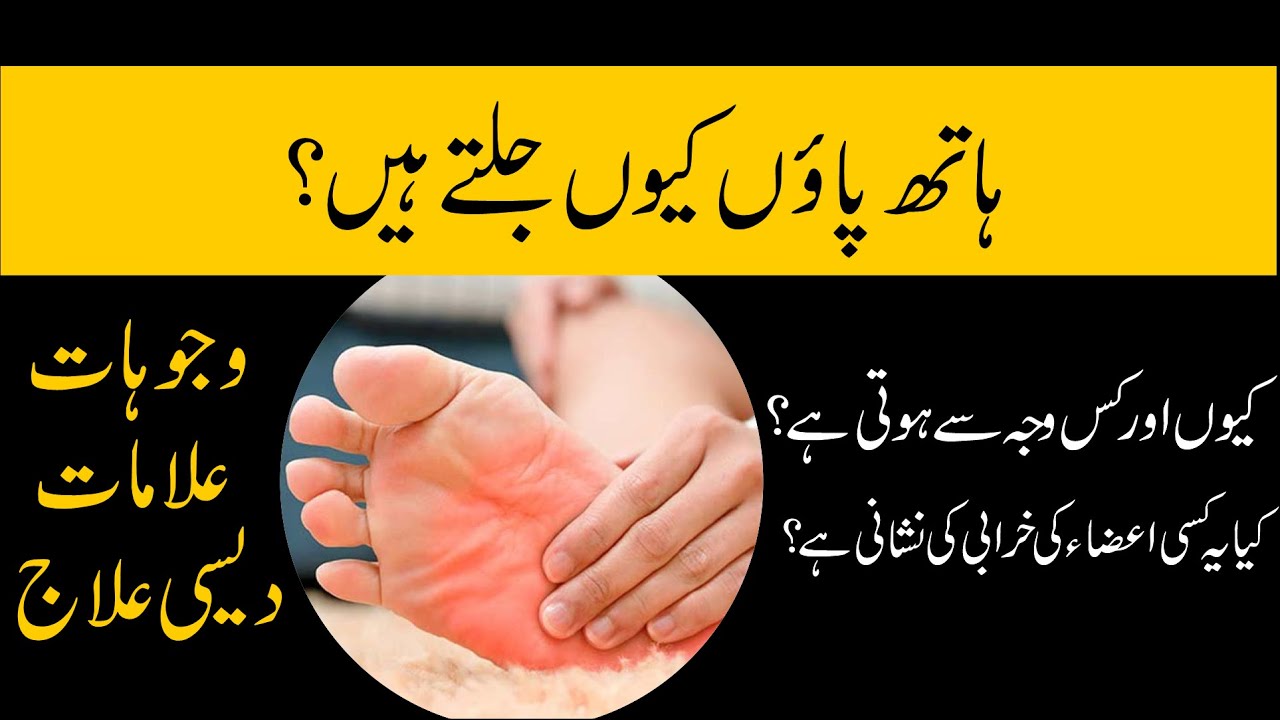 Burning Feet Syndrome Symptoms, Causes & Treatment In URDU By Dr. Maqsood Iqbal YouTube